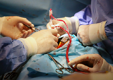 Cardiothoracic Suergery