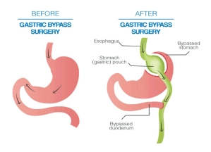 Non-Surgical Approach